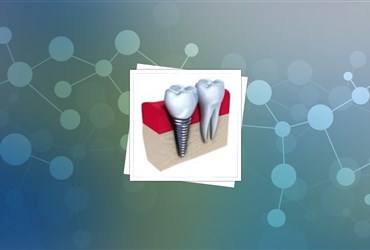 افزایش دوام دندان‌های کاشته شده در لثه با نانوکامپوزیت گرافنی