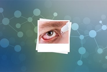 فناوری نانوکپسوله کردن داروی رفع خشکی چشم
