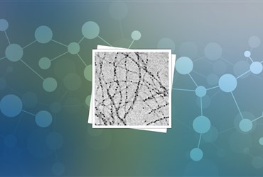 ترکیب نانوذرات آهن و نانوفیبریل پروتئینی