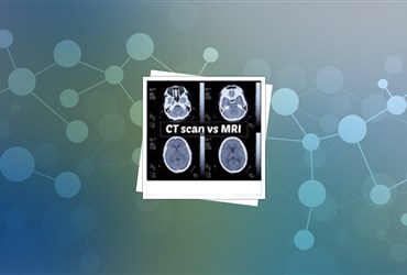دریافت حمایت مالی برای آزمون بالینی نانوعامل کنتراست دهنده MRI