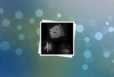استفاده از نانوحباب برای تصویربرداری از تومور