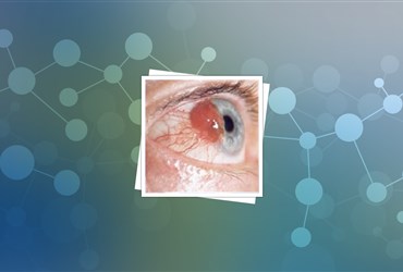 دریافت سرمایه‌ برای مرحله‌ی نهایی آزمون بالینی نانوداروی ضدسرطان چشم
