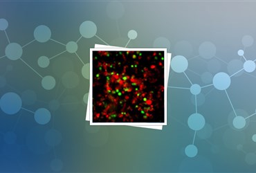 بهبود تصویربرداری با نانوذرات سیلیکون دارای پوشش رنگی