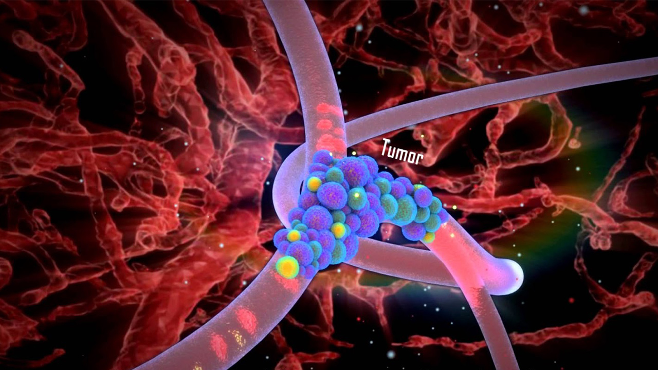 دارورسانی نوین به منظور هدف قرار دادن تومورهای سرطانی