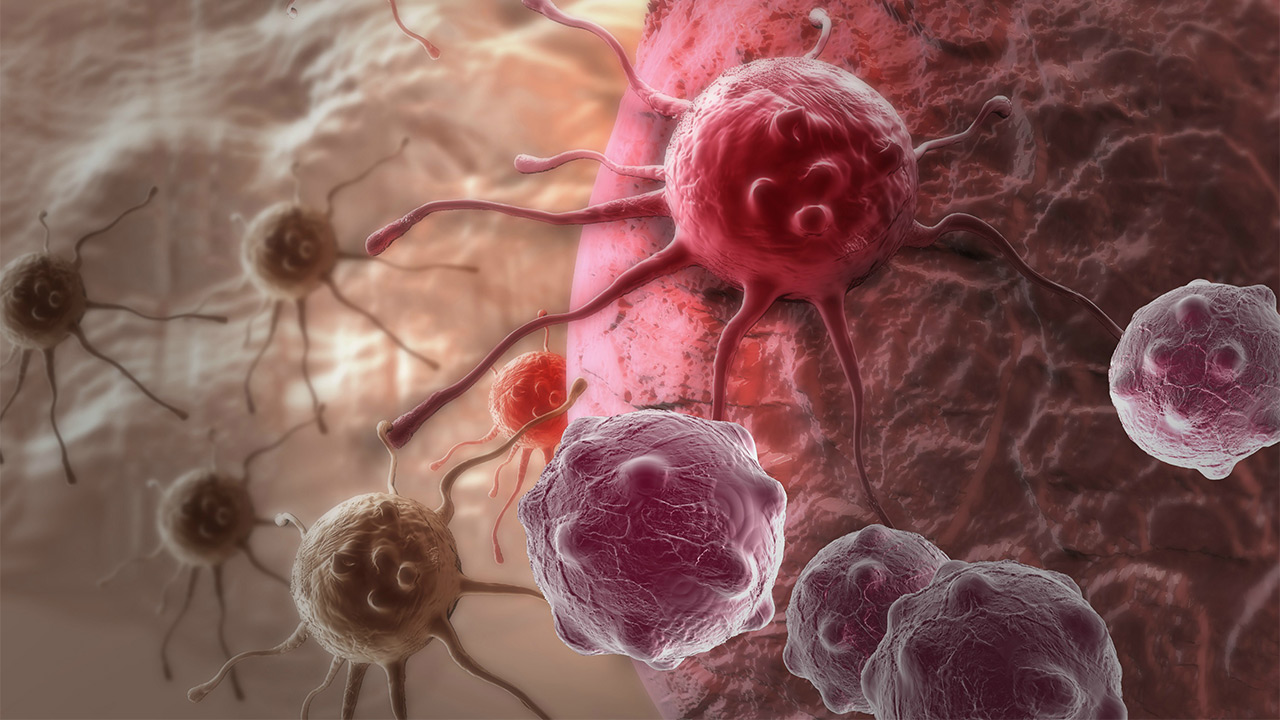 داروی شیمی‌درمانی و ویتامین B درون نانوذرات برای مقابله با سرطان