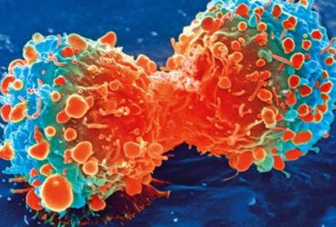 نانوذرات اکسیدمس قابلیت از بین بردن تومور سرطانی دارد