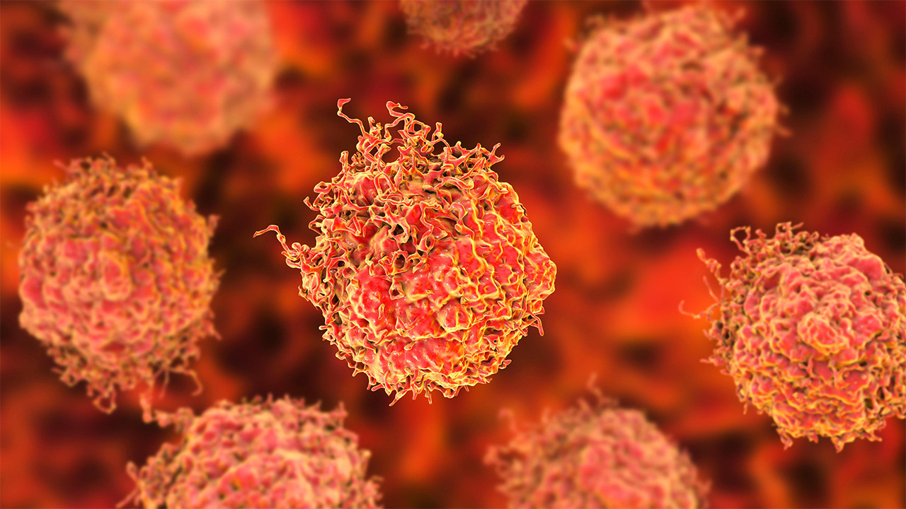 کارآزمایی بالینی روی نانوذراتی که بافت تومور را می‌سوزانند