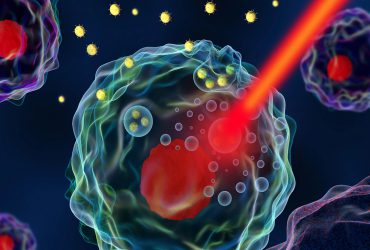 استفاده از لیزر و نانوذرات برای تشخیص زودهنگام سرطان