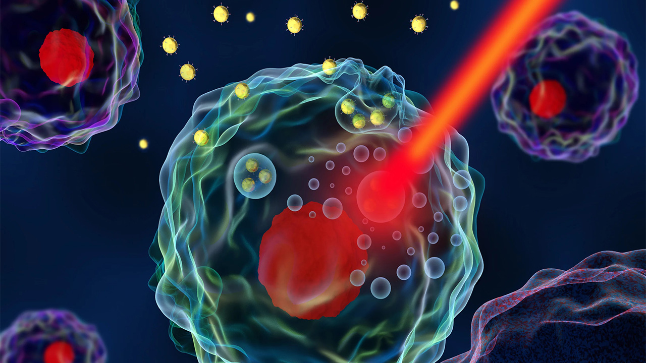 استفاده از لیزر و نانوذرات برای تشخیص زودهنگام سرطان