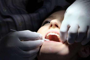 کمک نانوحفره به دندان‌پزشکان در کاشت ایمپلنت دندانی