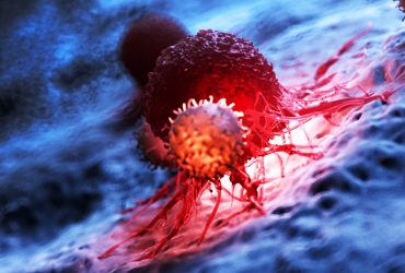 تولید نانوذراتی که تومور سرطانی را می‌سوزاند!