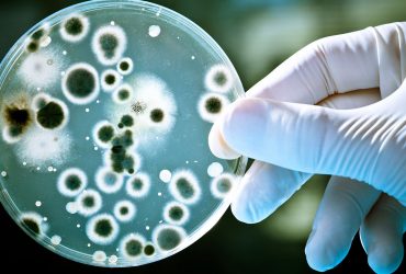 دانشگاه صنعتی شریف: زیست‌حسگر الکتروکرومی برای تشخیص چشمی باکتری‌های بیماری‌زا