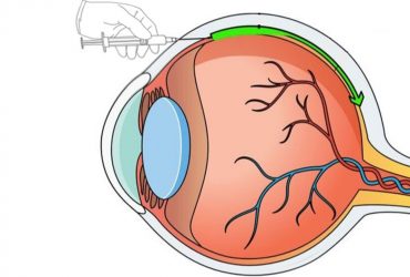 طراحی نانوذرات حامل ژن برای کمک به درمان بیماری‌های چشم