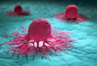 ثبت پتنت فناوری برای درمان انواع مختلف سرطان‌ها