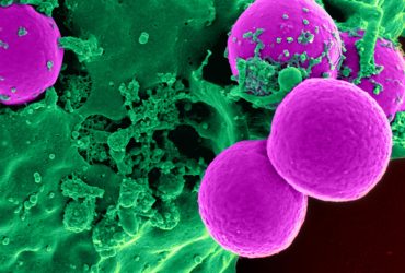 دستکاری ژنتیکی باکتری برای تولید نانوذرات با شکل و ابعاد دلخواه