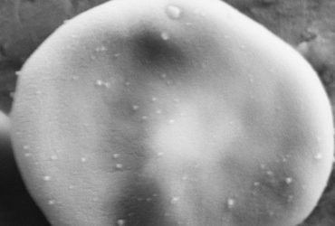 چگونه نانوذرات پوشش‌دار از چنگ سیستم ایمنی بدن فرار کردند؟