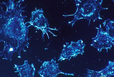طراحی نانوذراتی که فقط سلول‌های سرطانی را نابود می‌کنند