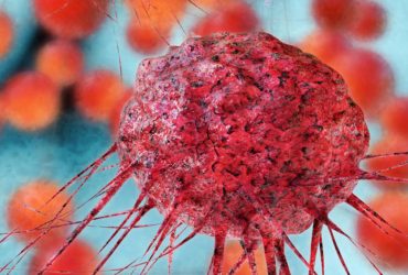 اثبات ضدتومور بودن نوعی نانوذرات در آزمون‌های بالینی