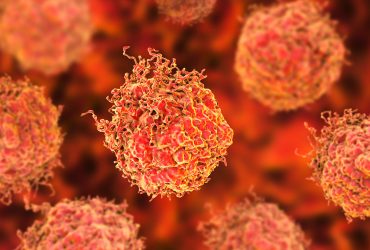 ترکیب رادیو داروها و نانوذرات برای از بین بردن تومور