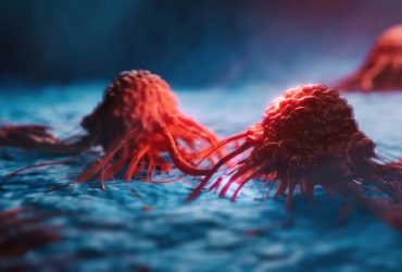 آسیب به DNA تومور سرطانی با نانوذرات مهندسی شده