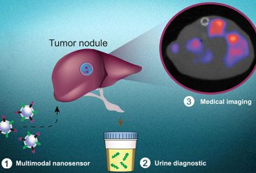 نانوذراتی که جای سلول‌های سرطانی را در بدن مشخص می‌کنند