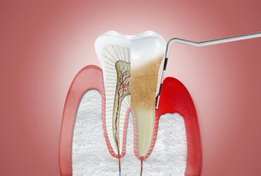 رهایی از بیماری‌های لثه و پوسیدگی دندان با نانوالماس