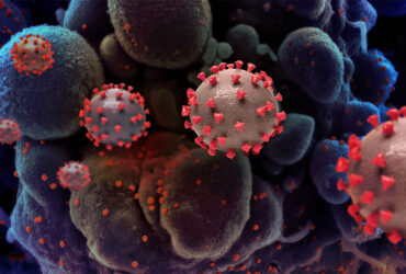 نانوحسگری برای تشخیص ویروس کرونا با چشم غیرمسلح
