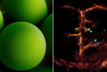 استفاده از نانولیپوزوم برای تصویربرداری از میکروربات‌ها در بدن