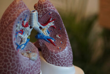 ترکیب دو فناوری که ممکن است سلول‌های سرطان ریه را از بین ببرد
