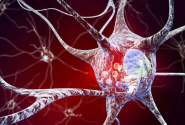 نانوبادی‌ها با عبور از بخش صعب‌العبور مغز، پارکینسون را درمان می‌کنند