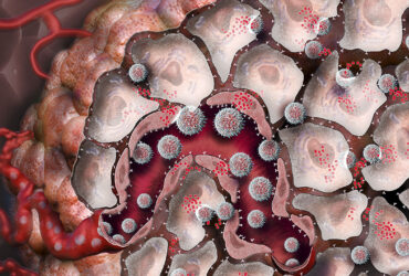 نانوذرات، سلول‌های ایمنی بدن را برای مقابله با سرطان آموزش می‌دهند
