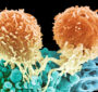 انتشار نتایج مثبت داروی ضدسرطانی که حاوی نانوذرات حامل mRNA است