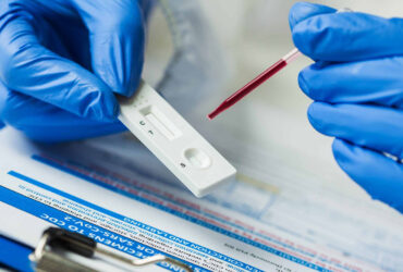 نانوحفره‌ها برای ساخت کیت‌های تشخیص طبی استفاده می‌شوند