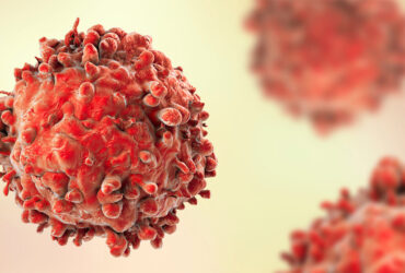 نانوذرات لیپیدی به کمک درمان سرطان خون می‌آید