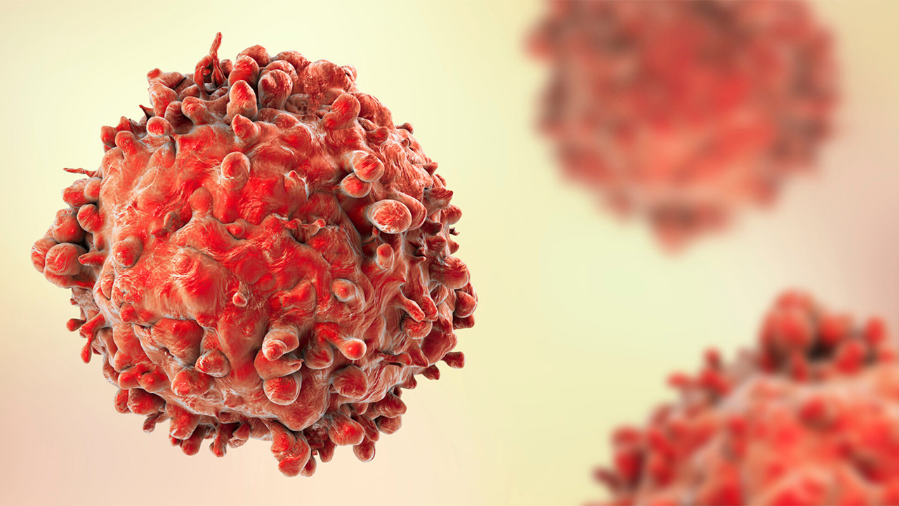 نانوذرات لیپیدی به کمک درمان سرطان خون می‌آید