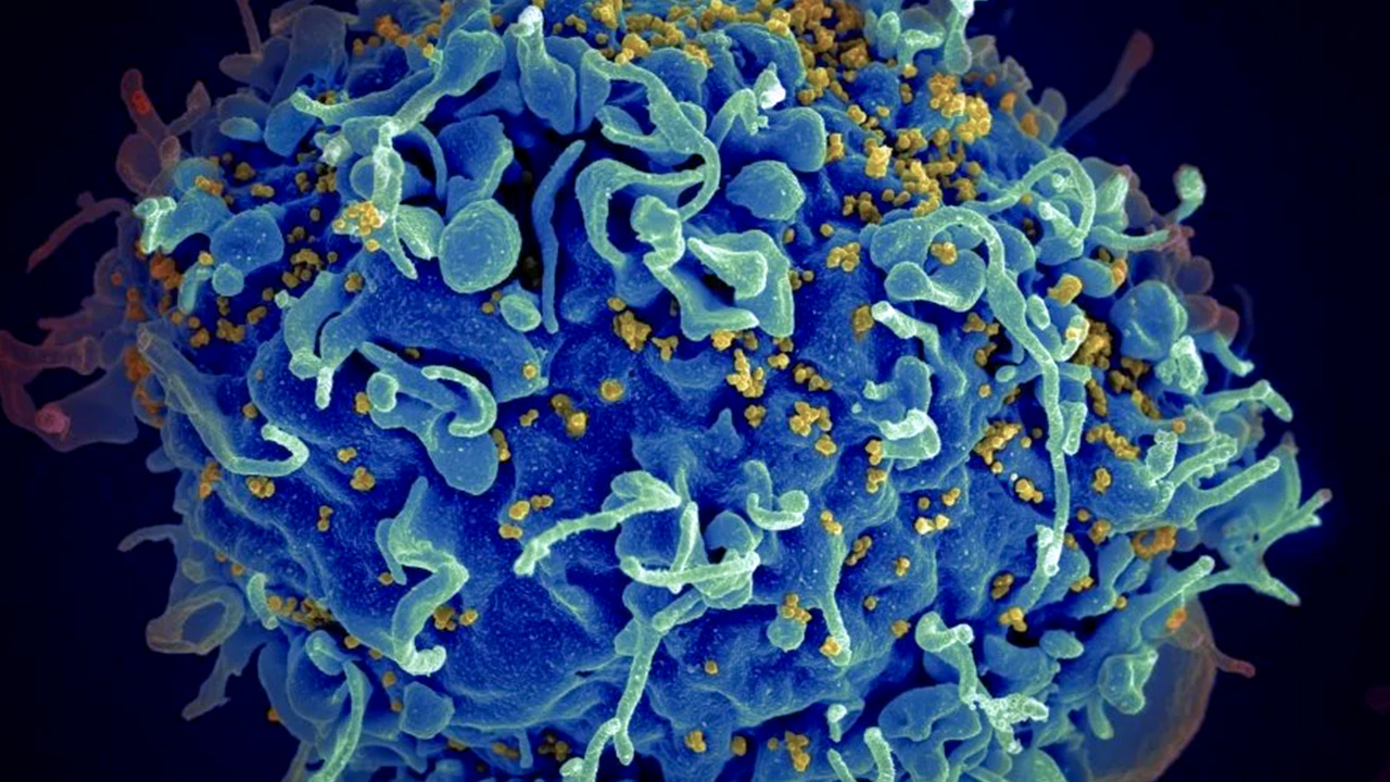 جنگ‌افزار جدید برای مقابله با HIV ساخته شد