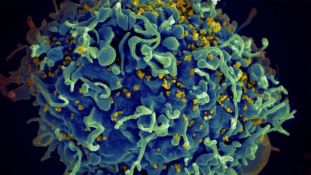 دام نانویی برای گیراندازی ویروس HIV پهن شد!