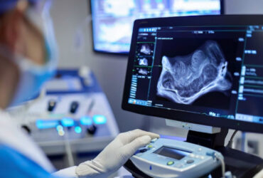 تولید میکروحباب‌های لیپیدی برای ارتقای دقت تصویربرداری سونوگرافی