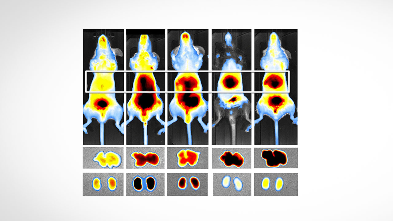 فلوویژن، چشم دیجیتال ساخت ایران برای رصد سرطان