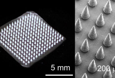 استارت‌آپ نانویی برای درمان‌های پوستی میکرونیدل تجزیه‌پذیر می‌سازد