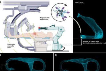 اسپرم‌روبات‌ها درمان ناباروری و انتقال هدفمند دارو را متحول خواهند کرد