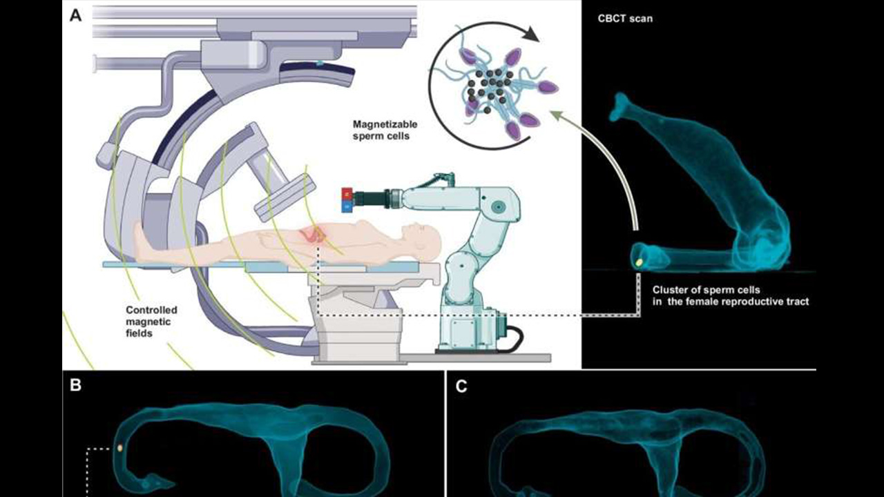 اسپرم‌روبات‌ها درمان ناباروری و انتقال هدفمند دارو را متحول خواهند کرد