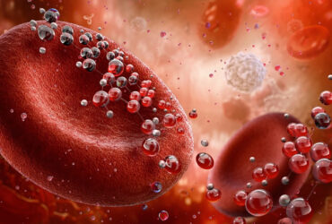 ساشه مکمل خوراکی آهن نانولیپوزومال، حاوی ویتامین‌های A و D3