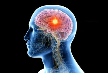 نانوحامل‌ هوشمندی که برای عبور بی‌دردسر دارو از سد تومور مغز طراحی شده است