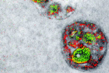 بیش از ۹۷٪ تصاویر میکروسکوپ الکترونی بلااستفاده باقی می‌مانند/ فرصت طلایی برای هوش مصنوعی