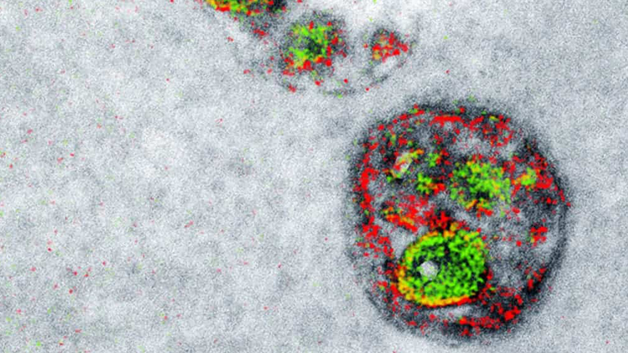 بیش از ۹۷٪ تصاویر میکروسکوپ الکترونی بلااستفاده باقی می‌مانند/ فرصت طلایی برای هوش مصنوعی