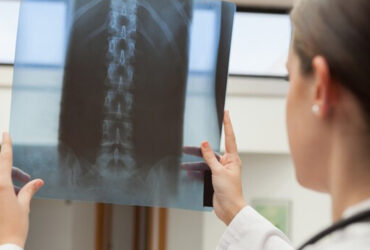 هیدروژل نانوزیم؛ امید تازه برای درمان کمردردهای مزمن و ترمیم دیسک بین‌مهره‌ای