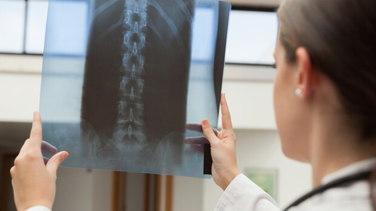 هیدروژل نانوزیم؛ امید تازه برای درمان کمردردهای مزمن و ترمیم دیسک بین‌مهره‌ای