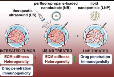 فروپاشی دژ نامرئی سرطان با فناوری نانوحباب