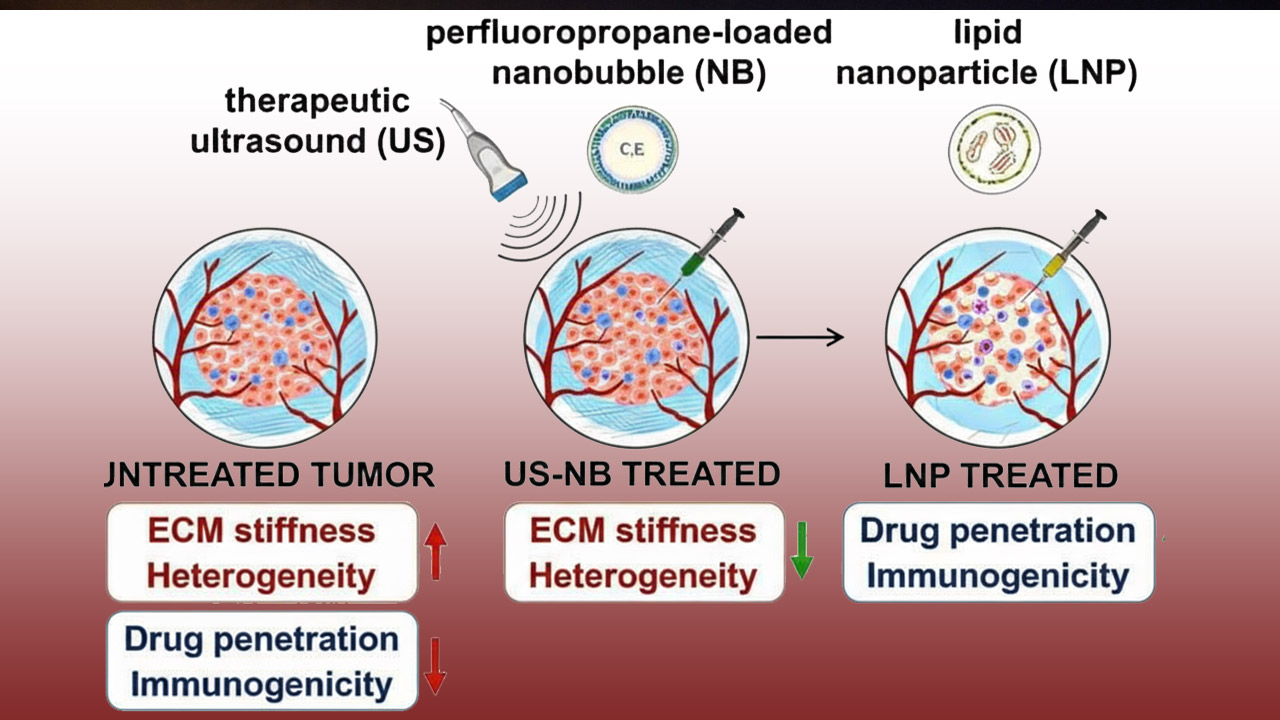 فروپاشی دژ نامرئی سرطان با فناوری نانوحباب